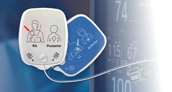 Defibrillation electrode pads in front of a patient monitor