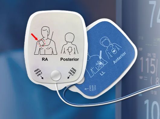 Defibrillation electrode pads in front of a patient monitor