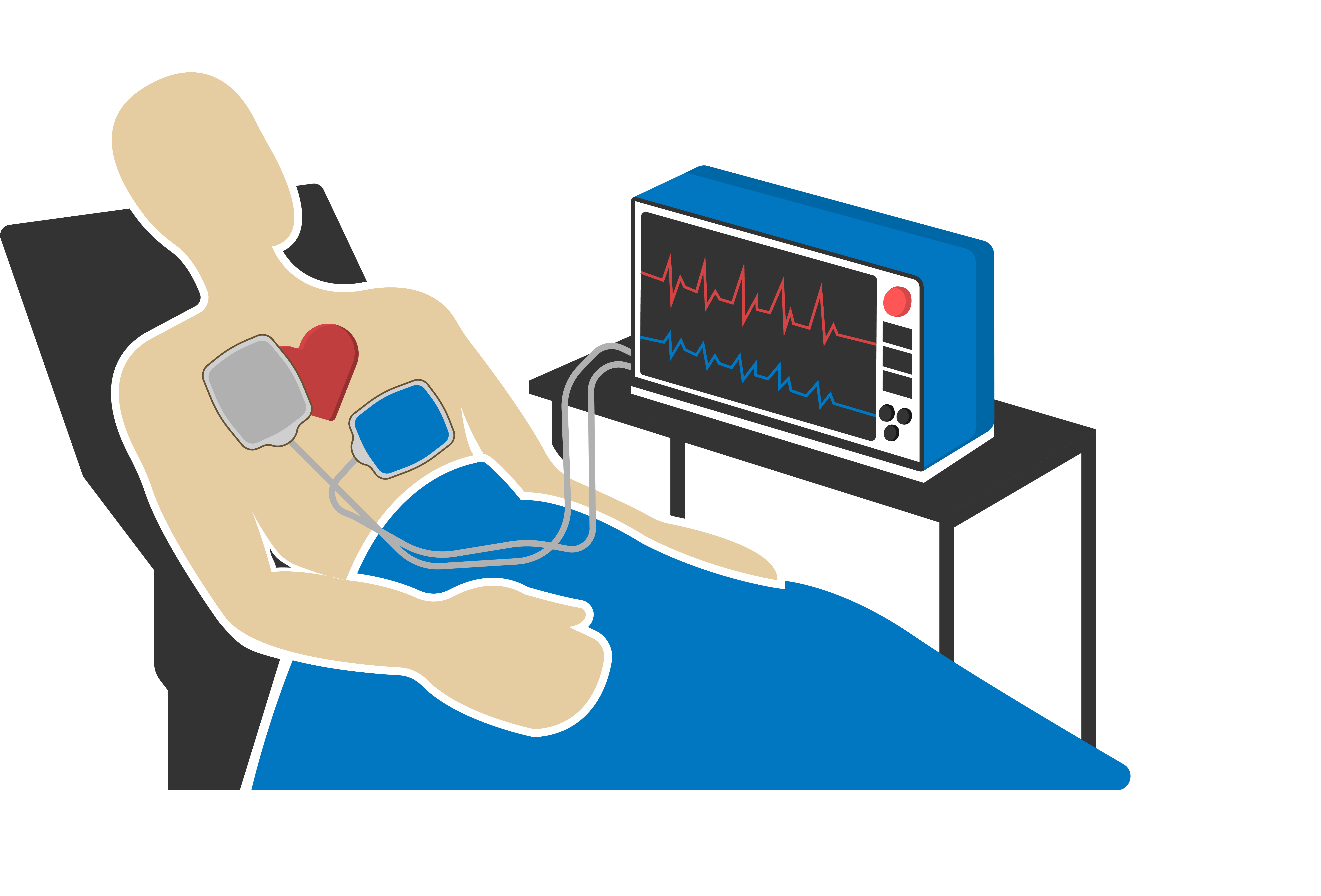 ECG monitoring graphic: patient with pads connected to a monitor